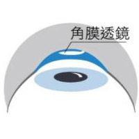 澄欣眼科診所 澄欣眼科診所