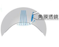 澄欣眼科診所 澄欣眼科診所