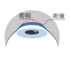 澄欣眼科診所 澄欣眼科診所