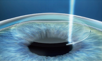 澄欣眼科診所 澄欣眼科診所