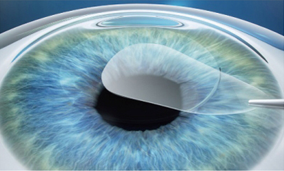 澄欣眼科診所 澄欣眼科診所