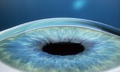 澄欣眼科診所 澄欣眼科診所