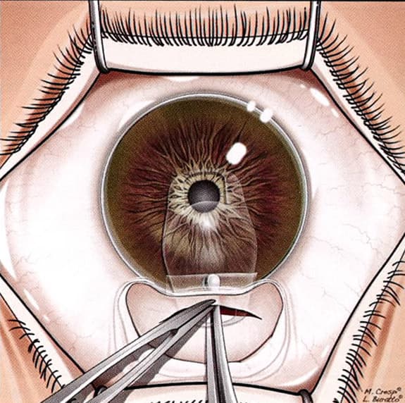 澄欣眼科診所 澄欣眼科診所