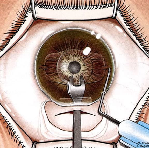 澄欣眼科診所 澄欣眼科診所